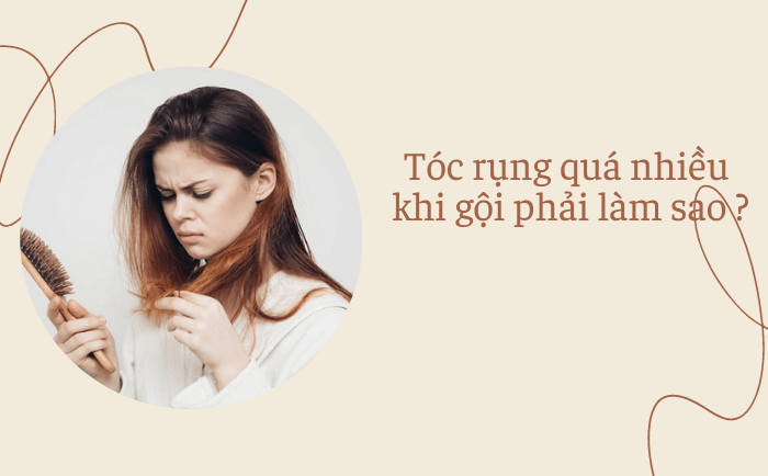 nguyên nhân tóc rụng nhiều