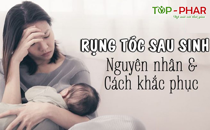 rụng tóc sau sinh