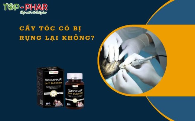Cấy tóc có bị rụng lại không?