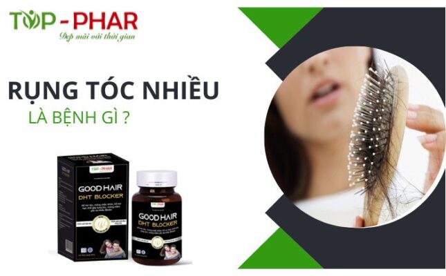 Rụng tóc nhiều